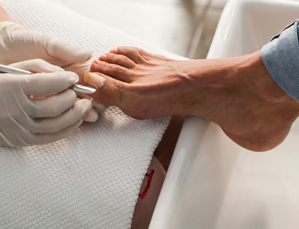 Medical pedicure at Nails Lindes